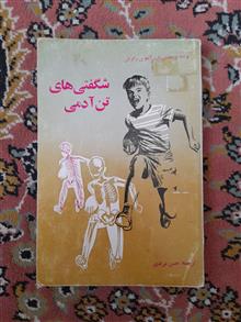 شگفتی