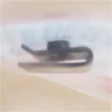 مهره