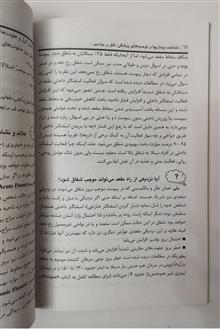 فتق