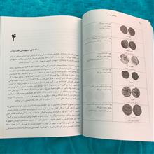 سکه