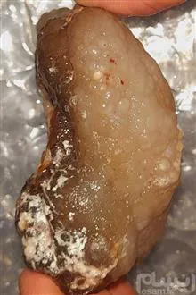 سنگ