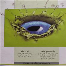 چشم