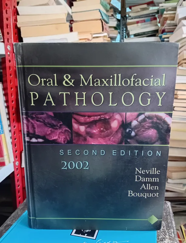 Oral and Maxillofacial PATHOLOGY