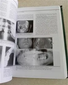 Oral