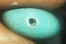 سنگ