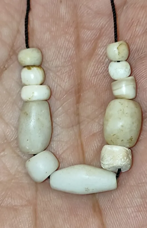 مجموعه مهره های درمانی معروف به مهره باد