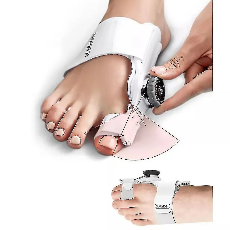 اصلاح کننده بونیون انگشت پا