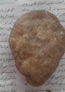 سنگ