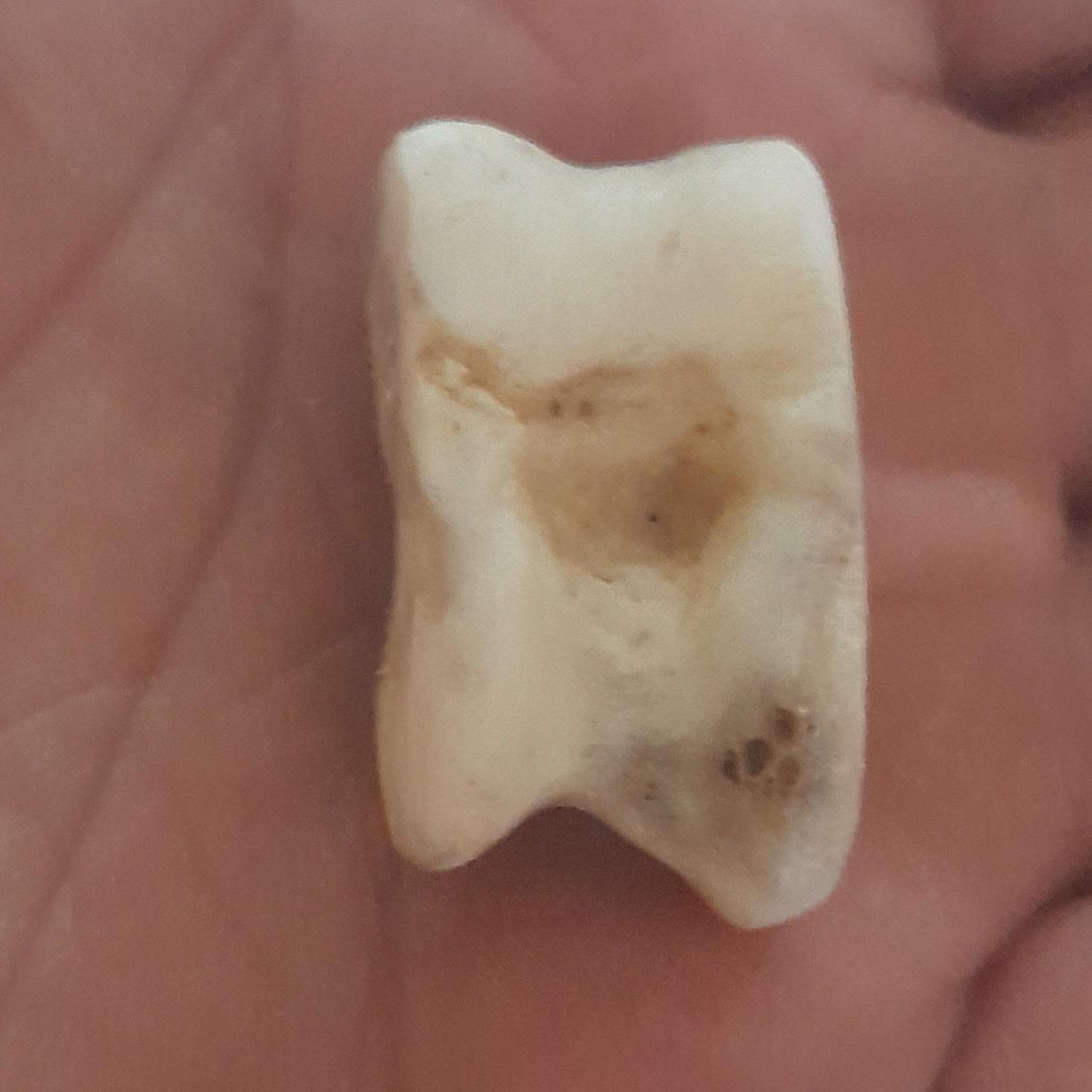 یک عدد مهره یا بجول یا قاب استخوانی