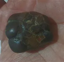 سنگ