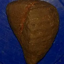 سنگ