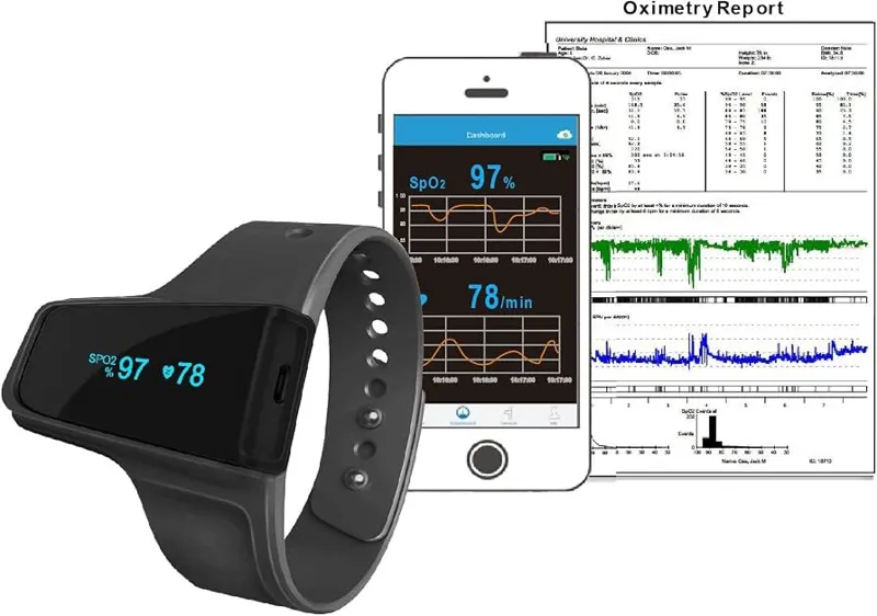 پالس اکسیمتر مدل Viatom Checkme O2 Max