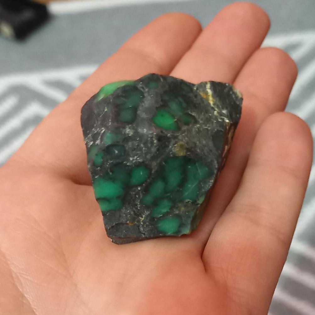 واریسیت عنکبوتی