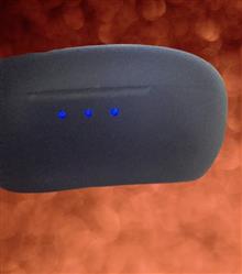کیس