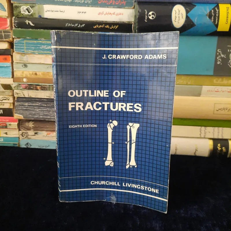 OUTLINE OF FRACTURES