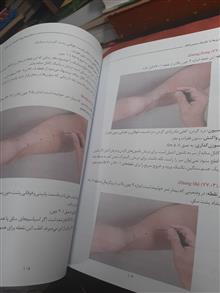 درمان