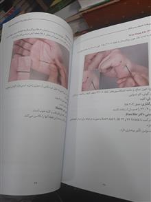 درمان