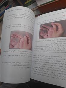 درمان