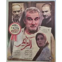 آلزایمر