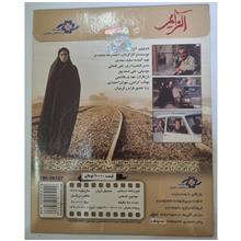 آلزایمر
