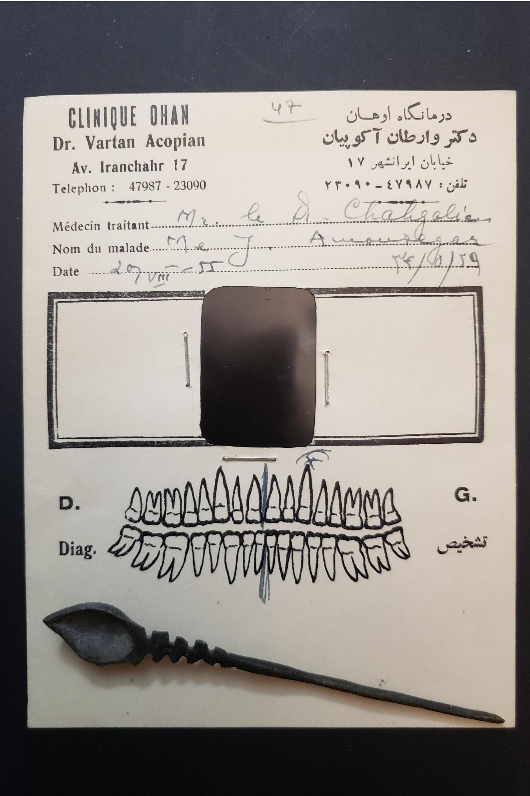 از اولین عکسهای رادیولوژی دندان 1334 شمسی