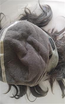پروتز