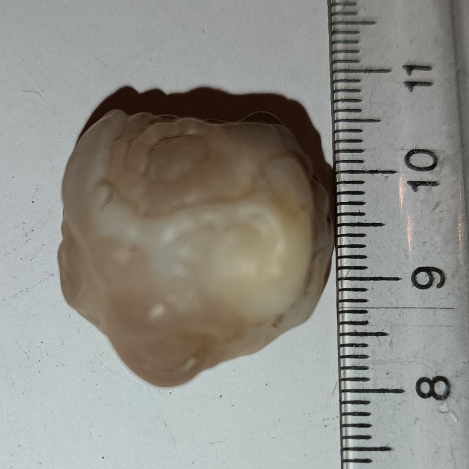 سنگ مهره فسیل زوعه چرب درشت چشم دار