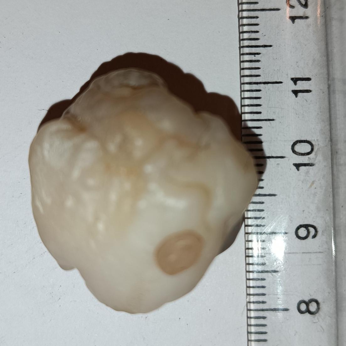 سنگ مهره فسیل زوعه چرب درشت