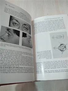 Eye