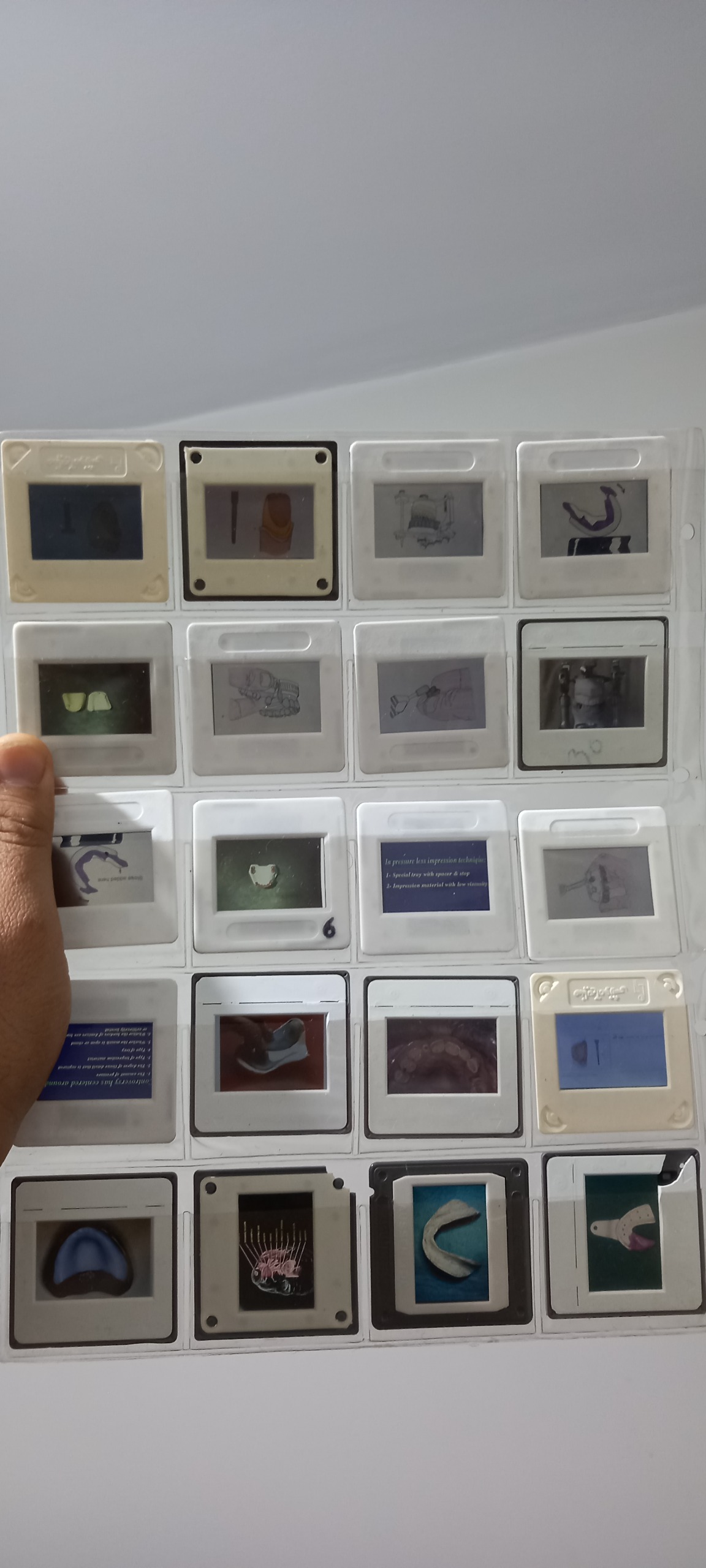 اسلاید دندان پزشکی