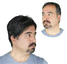 کلاه
