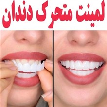 لمینت