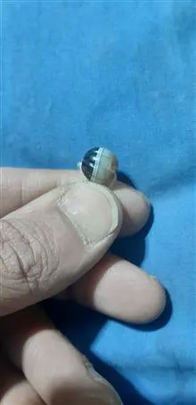 مهره