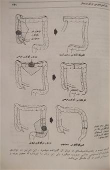 جراحی