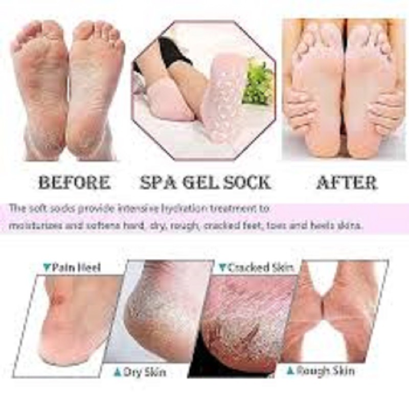 جوراب پاپوش طبی مراقبت و ضد ترک پا Spa Gel Socks