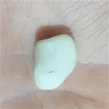 مهره
