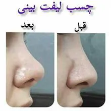 چسب