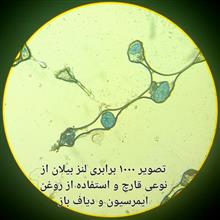 لنز
