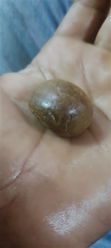 مهره