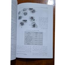 فشرده