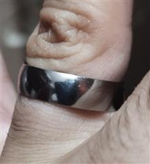 حلقه