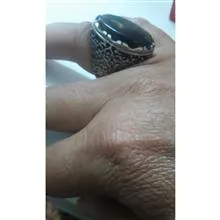 انگشترنطفه