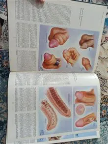 مجموعه