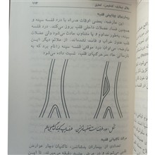 چگونه