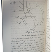 چگونه