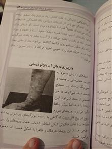 زالو