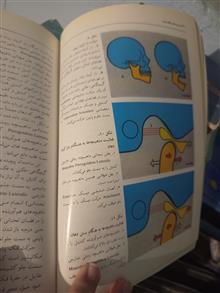 سردرد