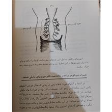 پیشگیری