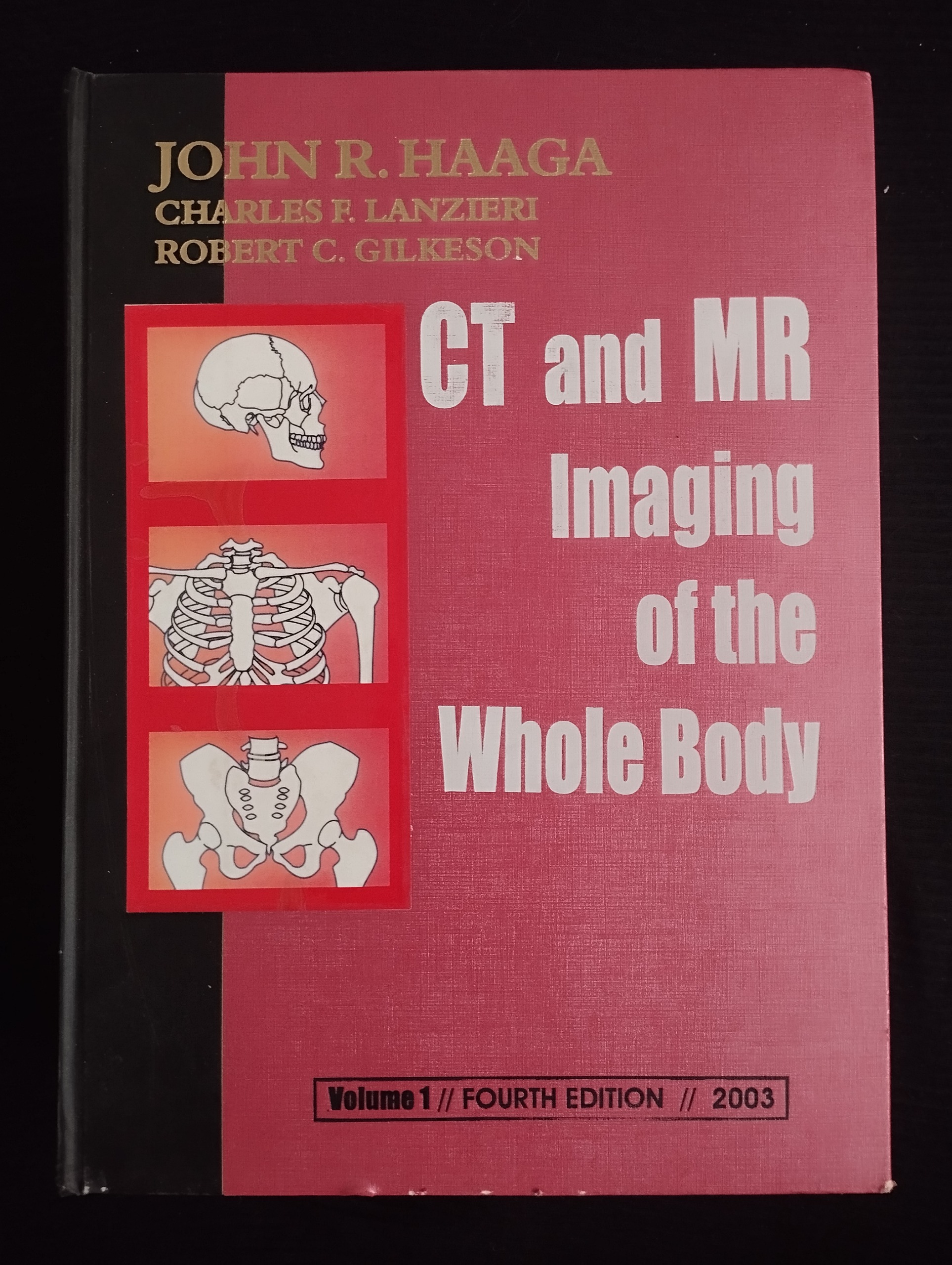 CT and MR lmaging Of the Whole Body جلد1