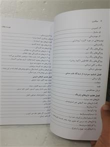 میگرن
